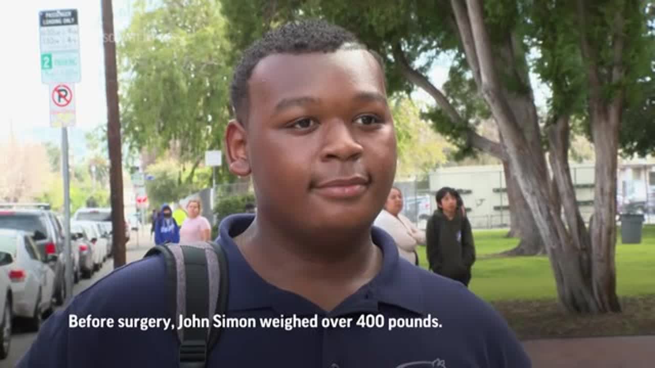 Obesity surgery offers teen a 'new life'