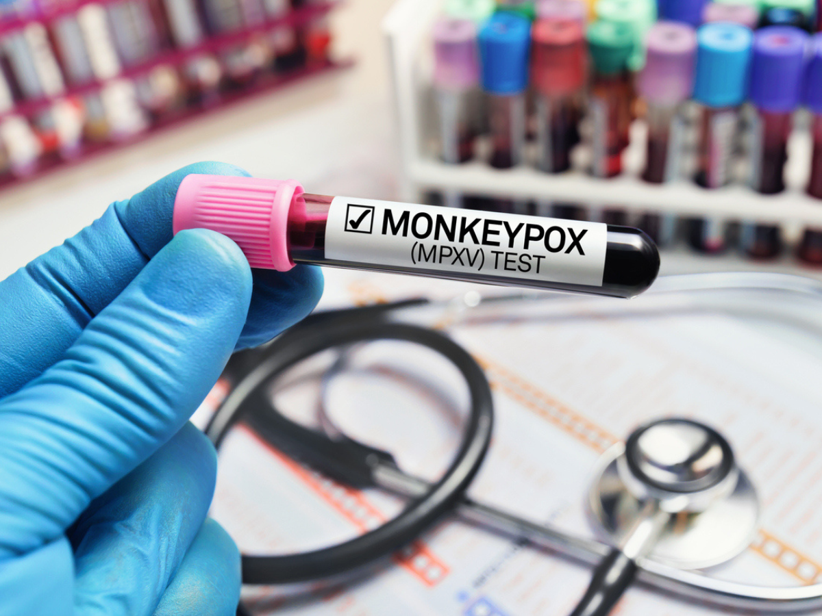 Cas d’infection par la variole du singe en Inde et symptômes à identifier