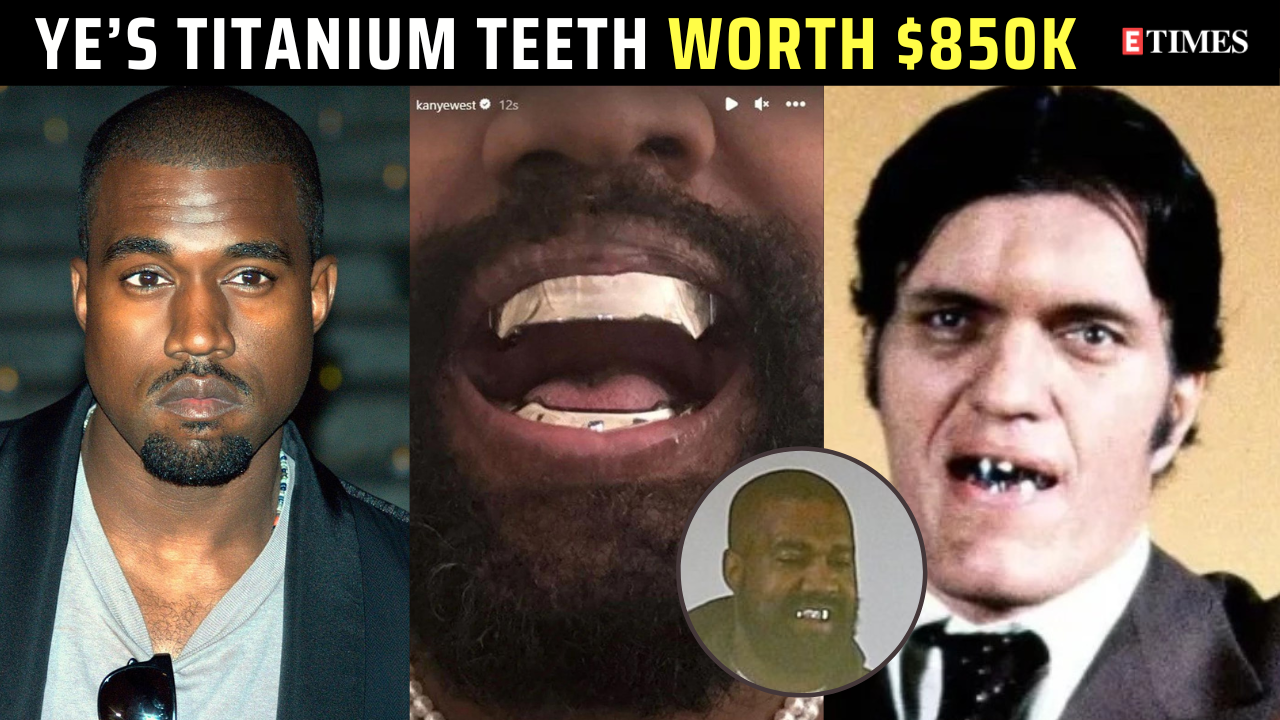 Kanye West debuts $850K titanium teeth inspired by James Bond villain