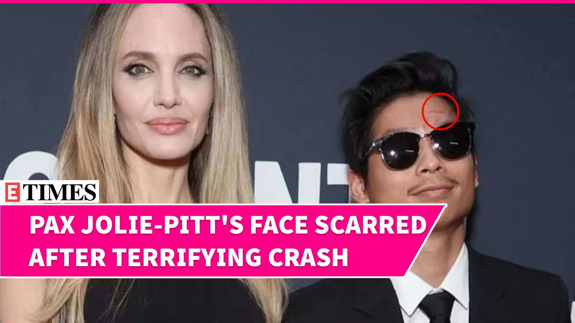 VIRAL! Actress Angelina Jolie's Son Pax Shows Off Scars At Toronto Festival Post Two Brutal Accidents