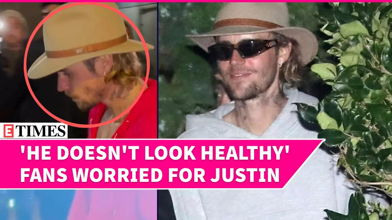 Justin Bieber’s Latest Photos Raise Health Concern Amid Diddy Controversy