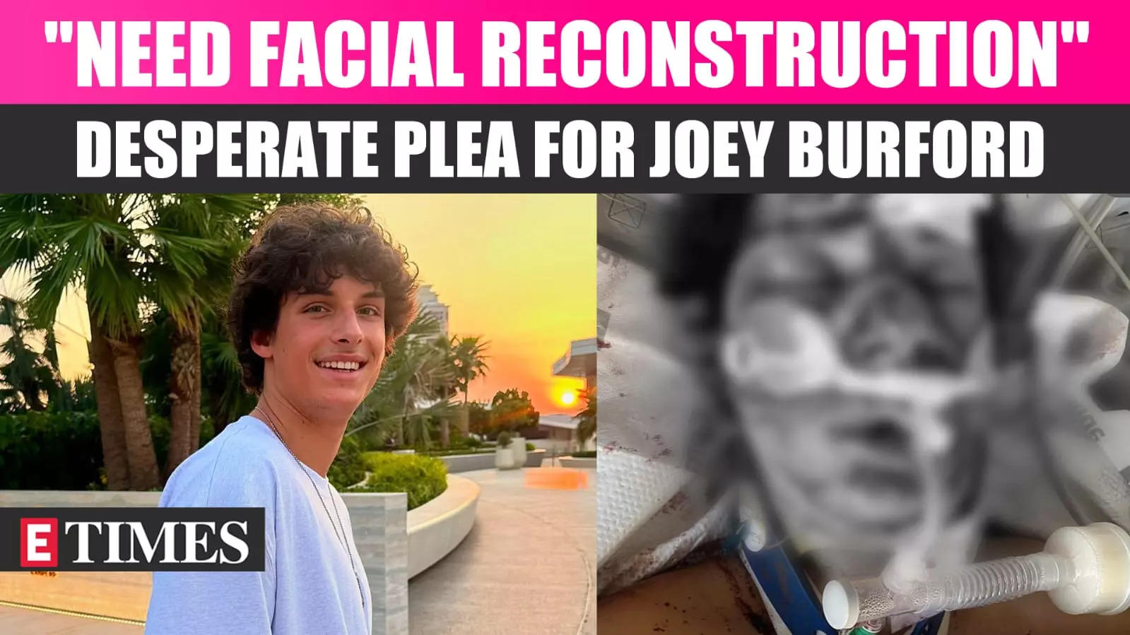 MILF Manor Star Joey Burford’s Facial Reconstruction Surgery Post Scooter Crash: Kelle Mortensen Shares Heartfelt Plea For Donations