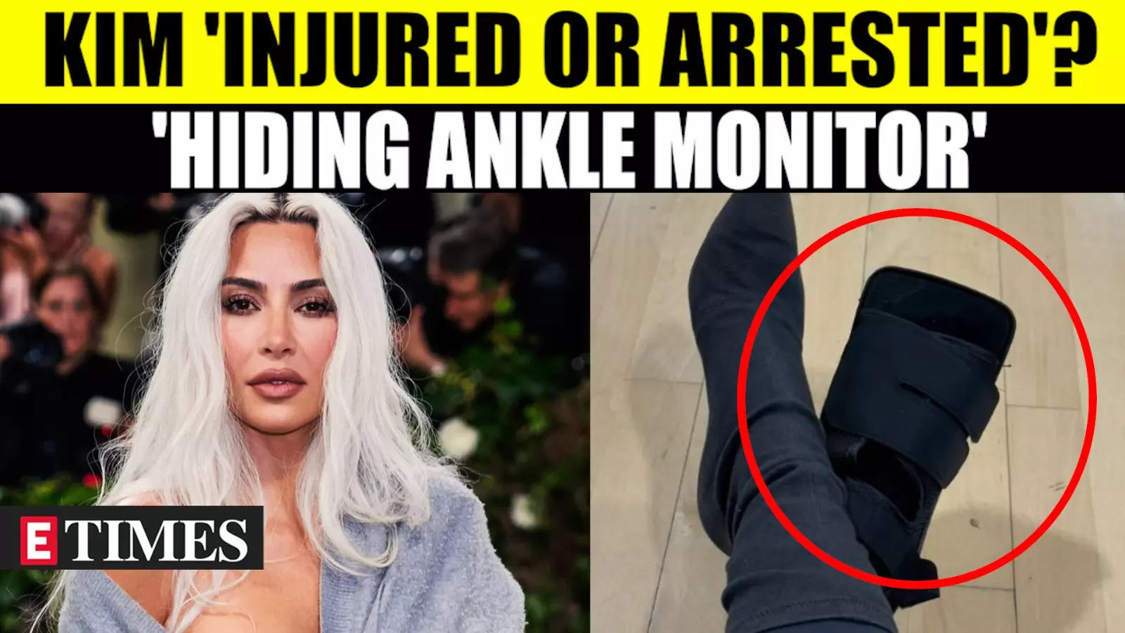 Kim Kardashian’s ‘Leg Injury’ Sparks Online Speculation