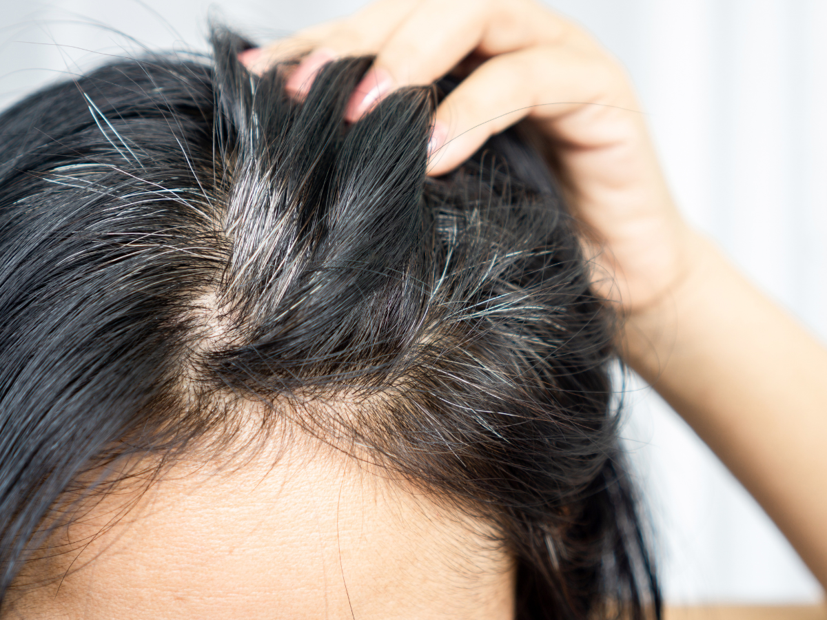 Prevent Premature Greying of Hair With These Tips