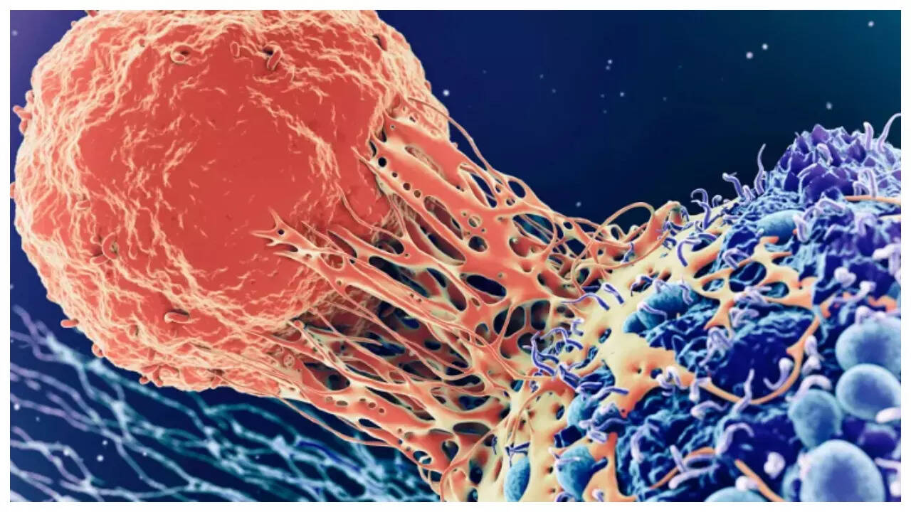 5 early symptoms of Sarcoma Cancer