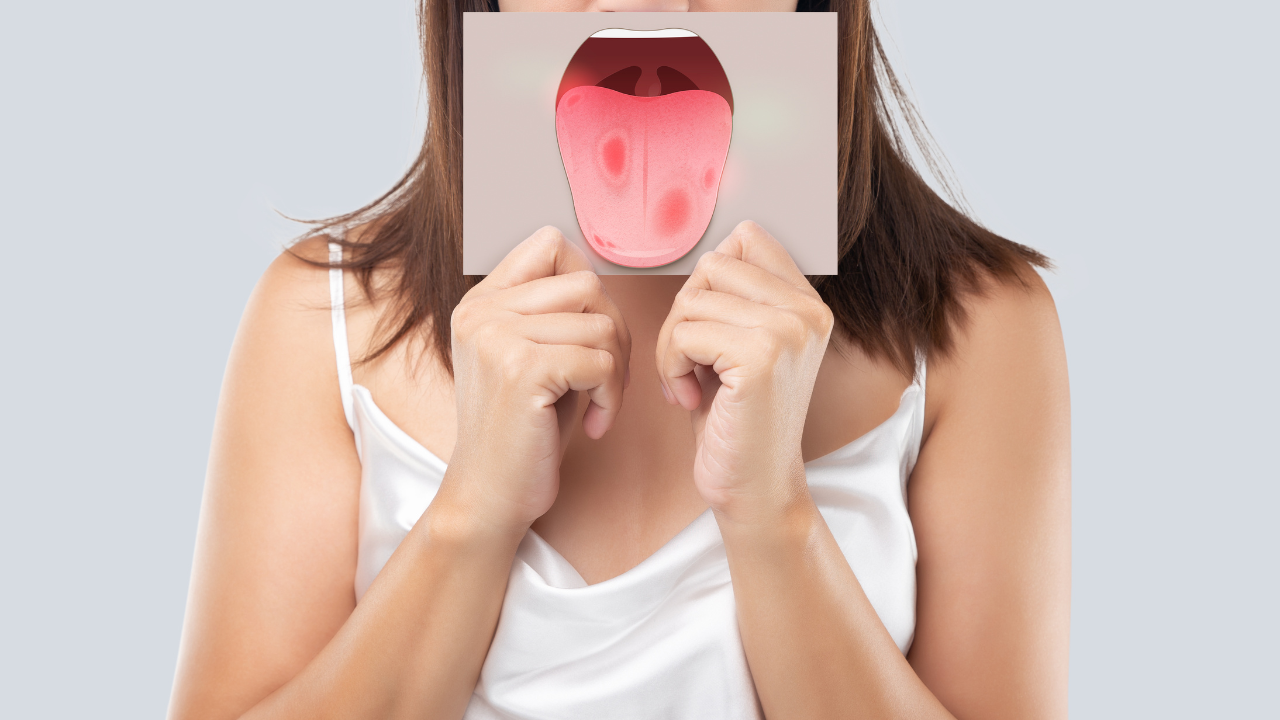 Your Tongue's Appearance: A Cornell Doctor Reveals Clues to Your Health