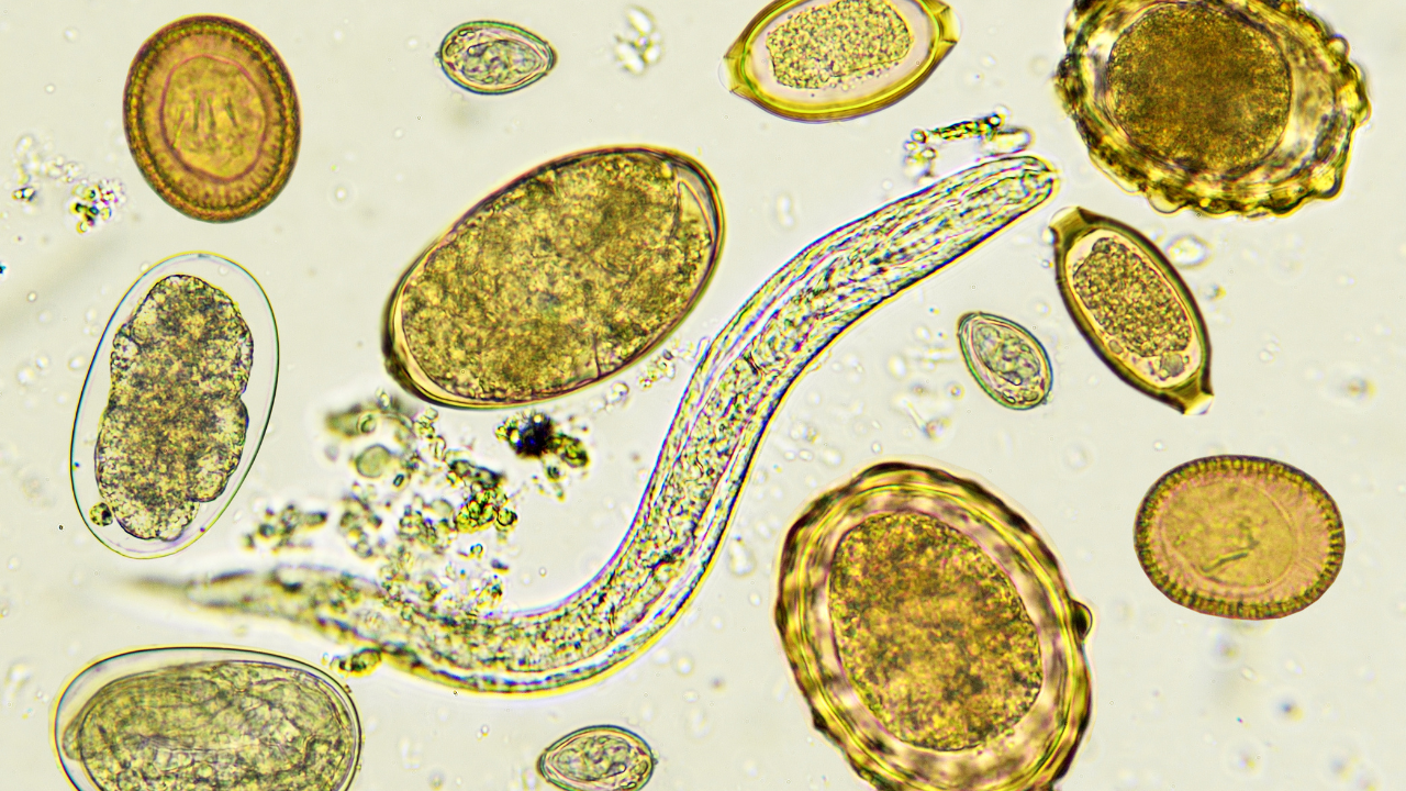Intestinal parasites: Consuming THIS seed might relieve symptoms, and cleanse the stomach