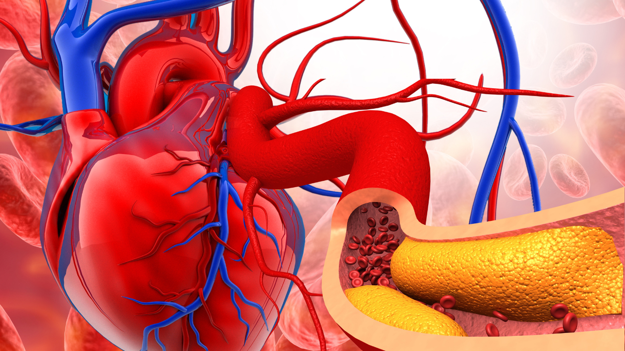 Cardiologist recommends adding 5 foods to our diet to reduce heart blockages and repair blood vessels