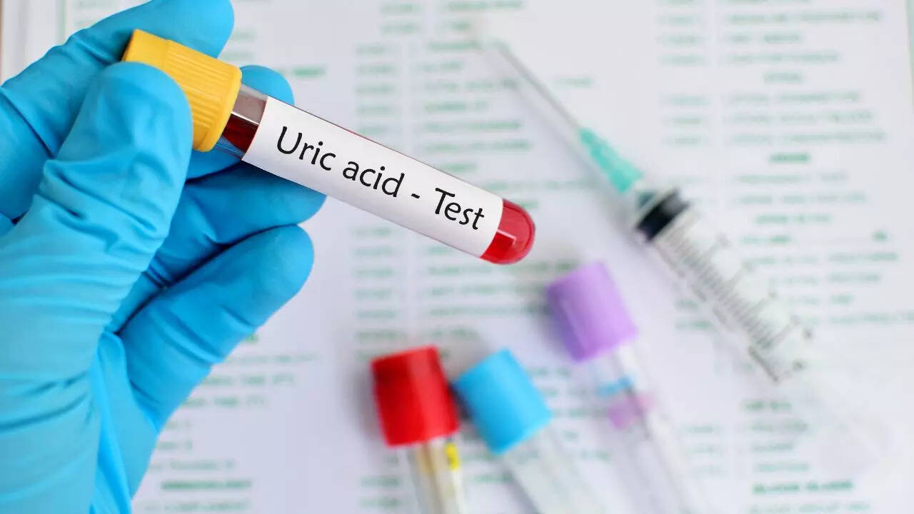 High uric acid and kidney stones: 5 warning signs you shouldn’t ignore