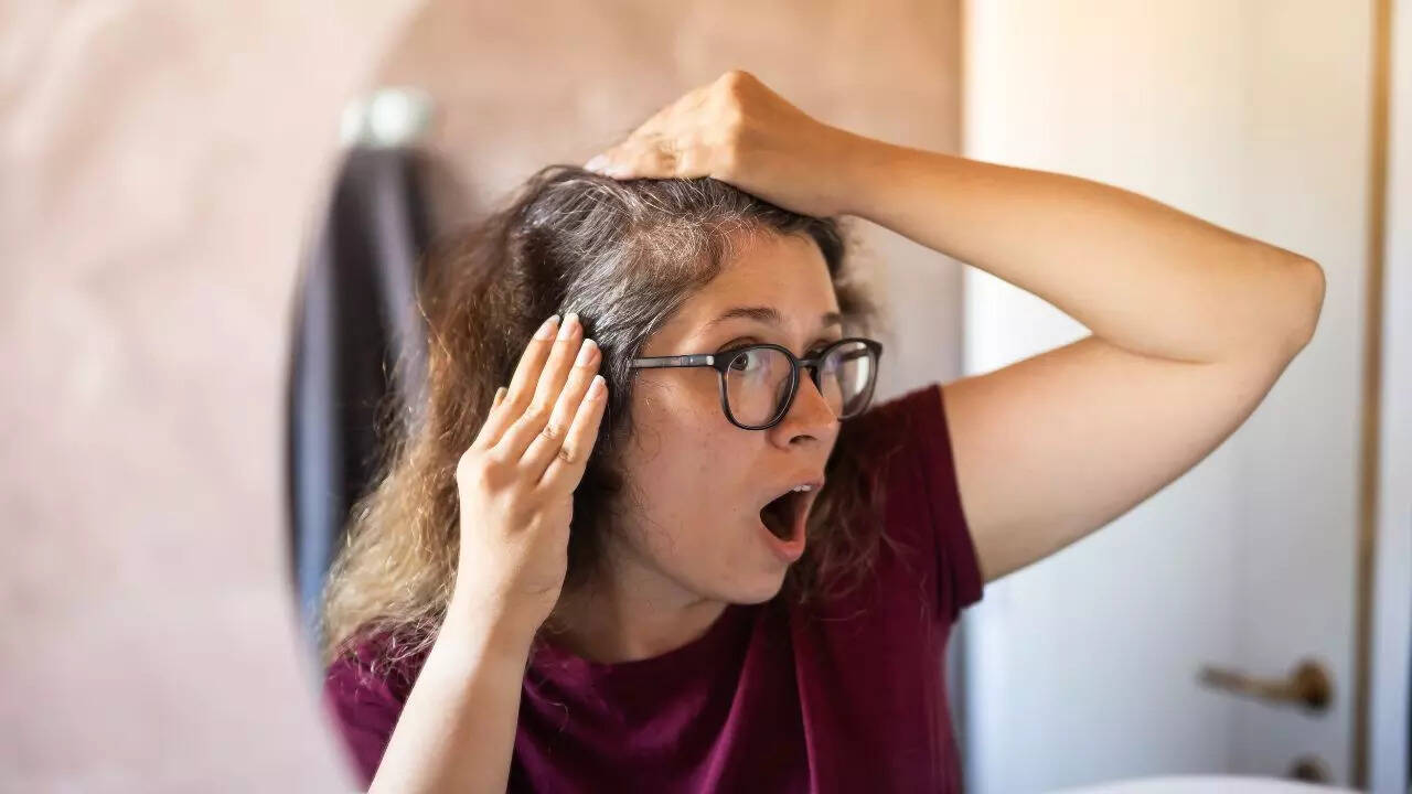 5 foods that may help slow down or prevent premature graying of hair