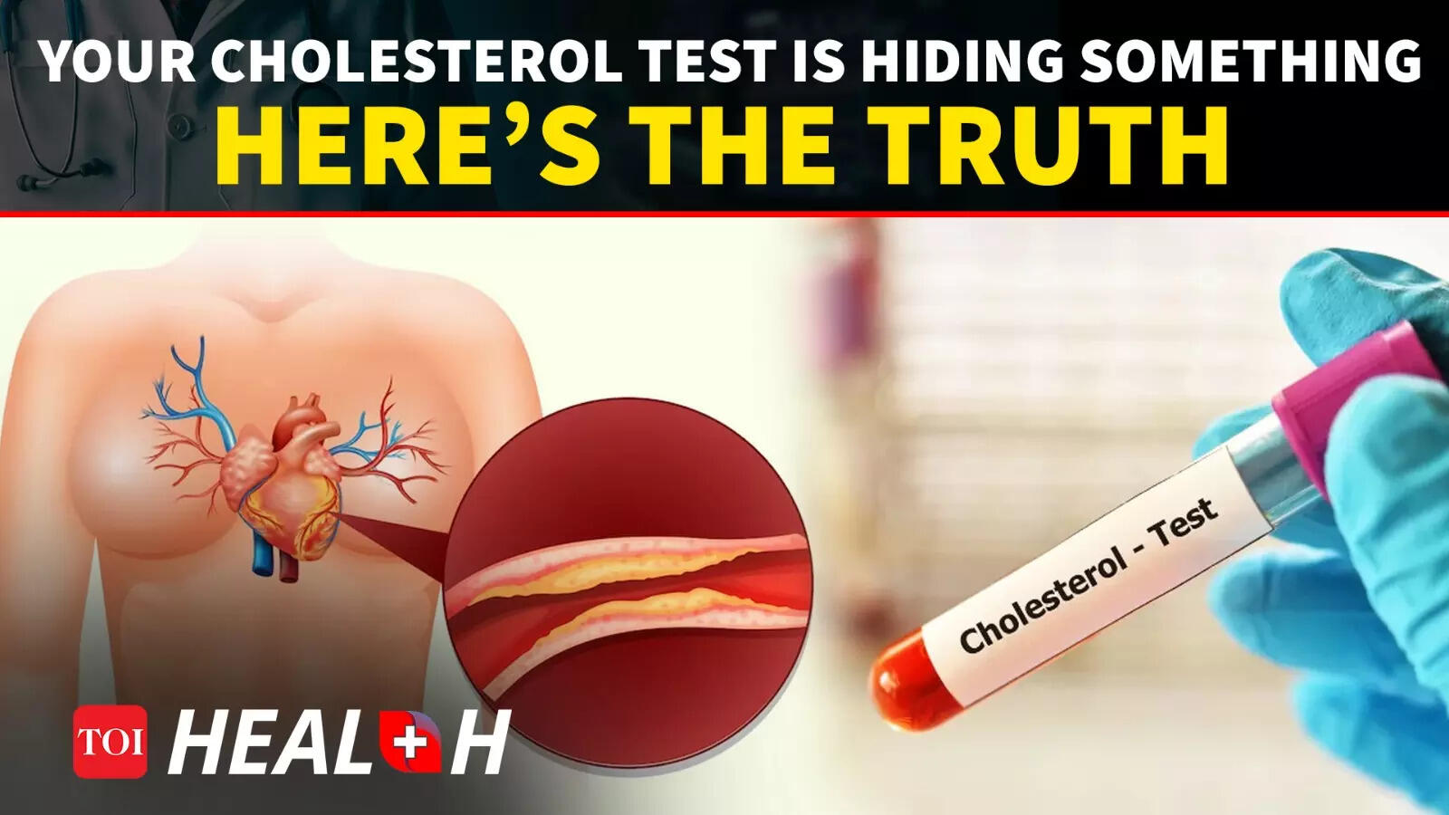 What Your Cholesterol Report Is Hiding &mdash; The Truth That Could Save Your Heart | Dr Vinayak Agarwal
