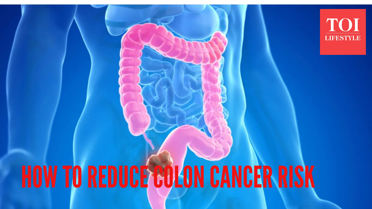 Colon Cancer Symptoms: 5 uncommon signs and ways to reduce your risk, as per top Harvard doc-scientist