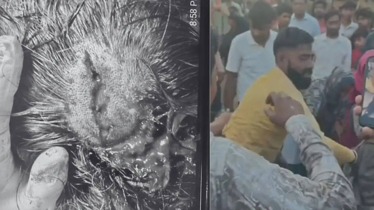 Attempt to save injured dog turns violent in Faridabad; rescuer critical, undergoes emergency surgery