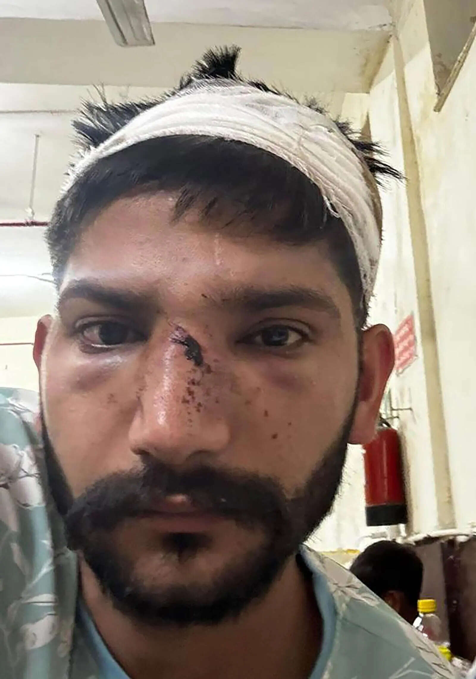Man, brother attacked with hammer and rods over court testimony, FIR against 8