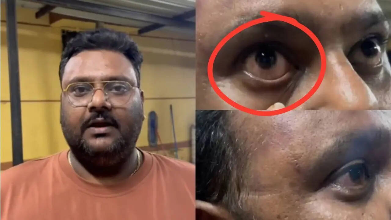 Pune techie, family attacked after bike brushes against MUV