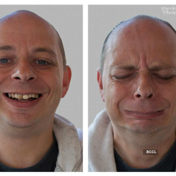 Bipolar Disorder: A silent killer