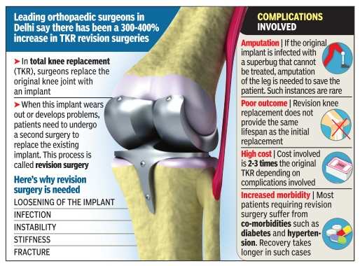 Why New Knee Isn T The Final Answer Times Of India