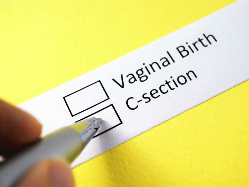 Image result for vaginal birth after cesarean