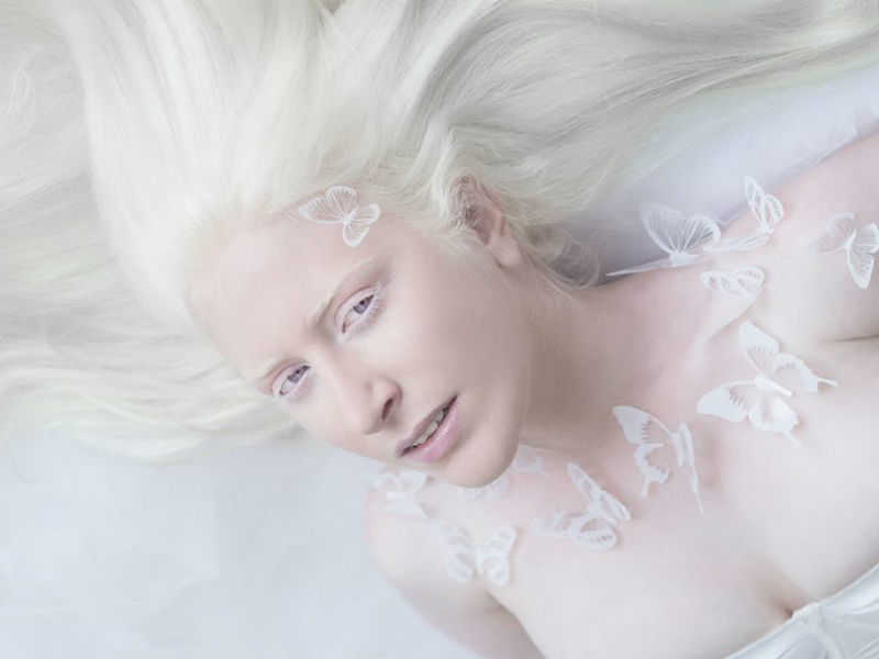 white skin disorder,white skin albino,what is albinism,porclain beauty,albi...