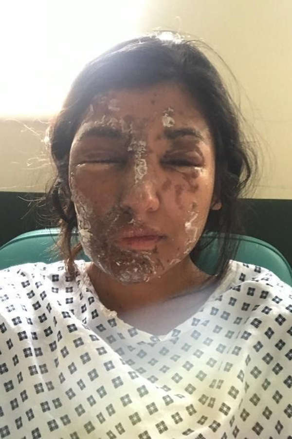 Acid attack victim Reshan Khan’s open letter asks for “a zero-tolerance stance”