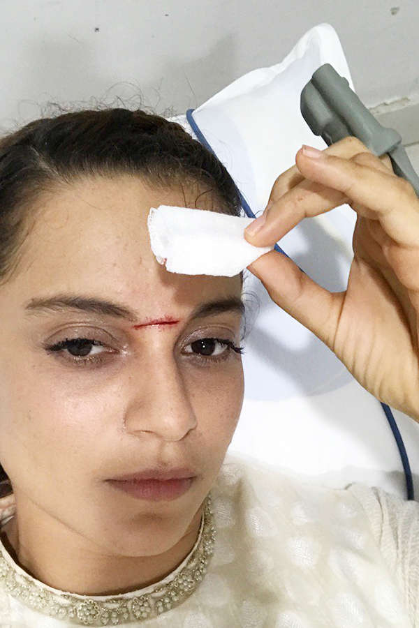 Kangana Ranaut severely injured on the sets of ‘Manikarnika’