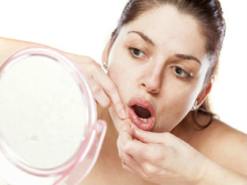 ​Treat acne and its scars