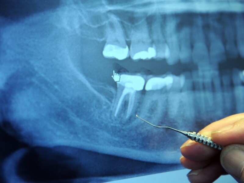 Design a mobile social app for a chain of local orthodontist offices.