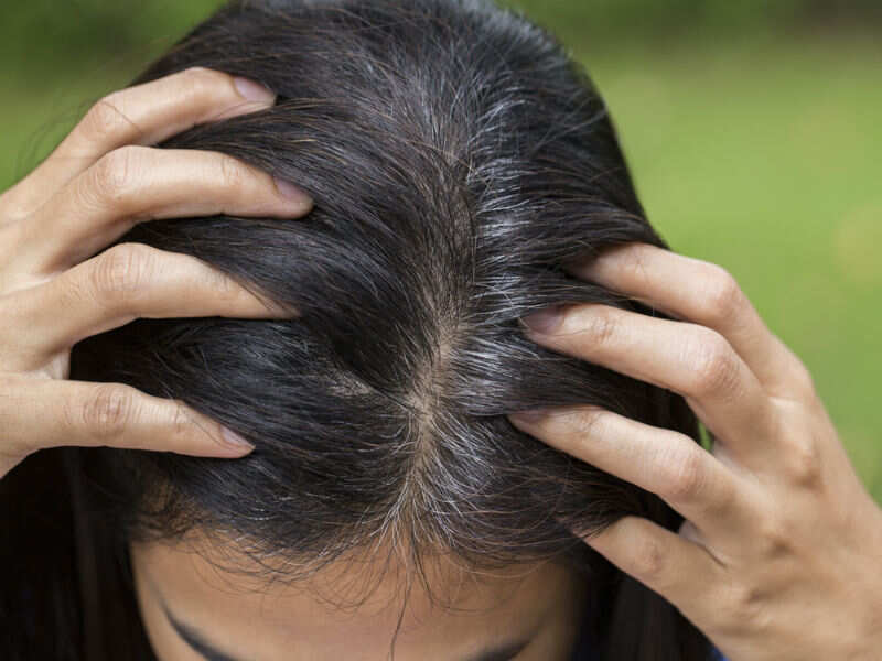 Grey Hair Home Remedies How To Get Rid Of Grey Hair Naturally