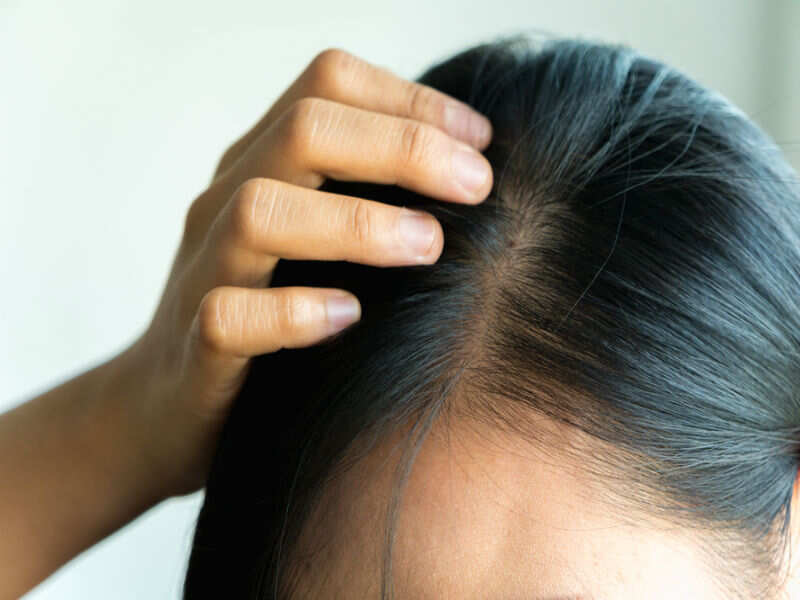 Grey Hair Home Remedies How To Get Rid Of Grey Hair Naturally