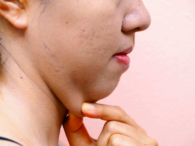 Exercises for best sale reducing double chin