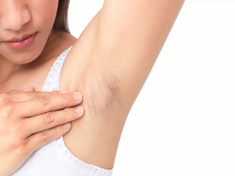 Why Do My Armpits Itch? - Common Causes and Treatments of Itchy