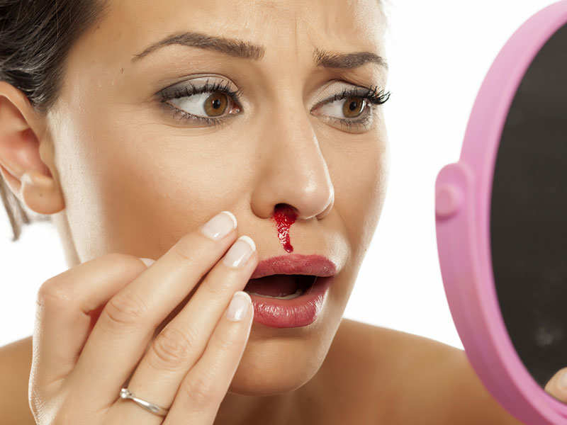 10 home remedies to stop nose bleeding instantly | The Times of India
