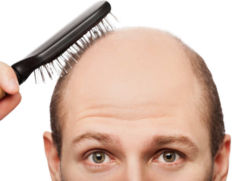 can diet reduce balding