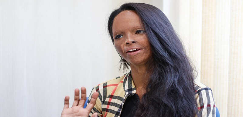 Acid attack survivor's story: 'Mostly it is the women who bully'