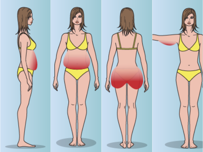 4 types of body fat: Which one do you have?