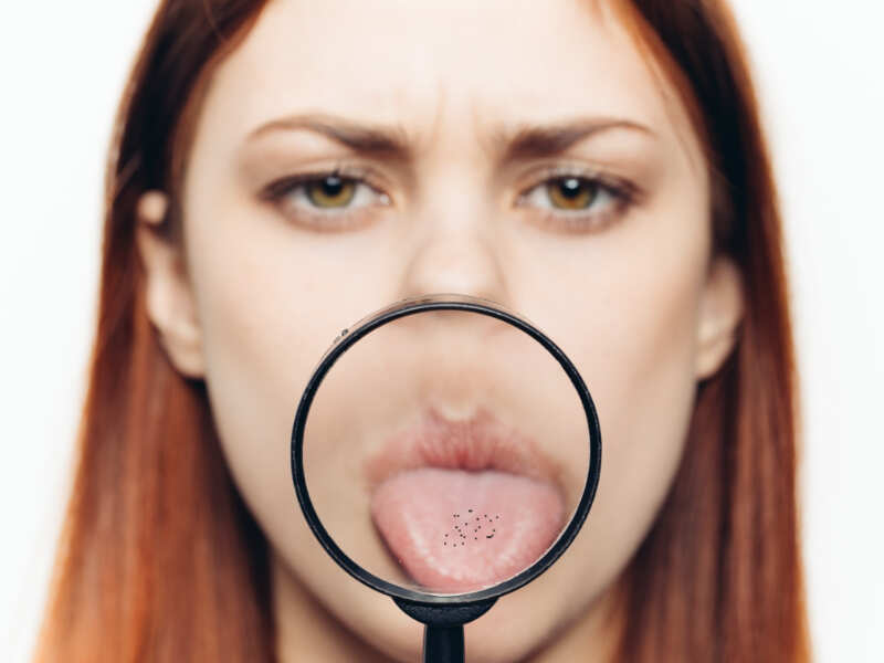 what-are-those-black-spots-on-your-tongue-the-times-of-india