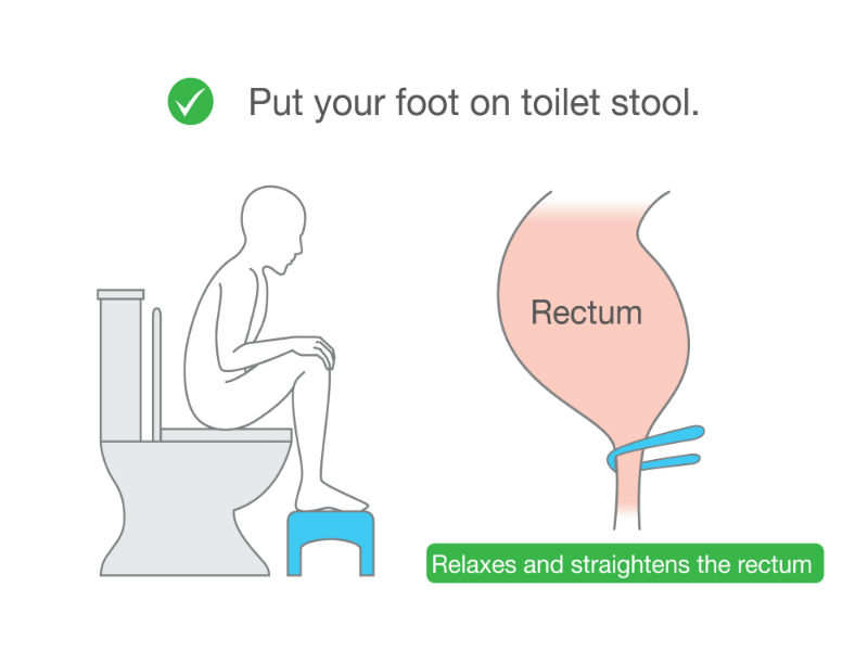 shutterstock_661729489 toilet stool