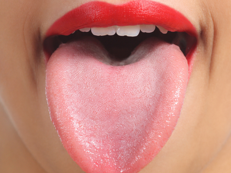 Tongue Color Chart