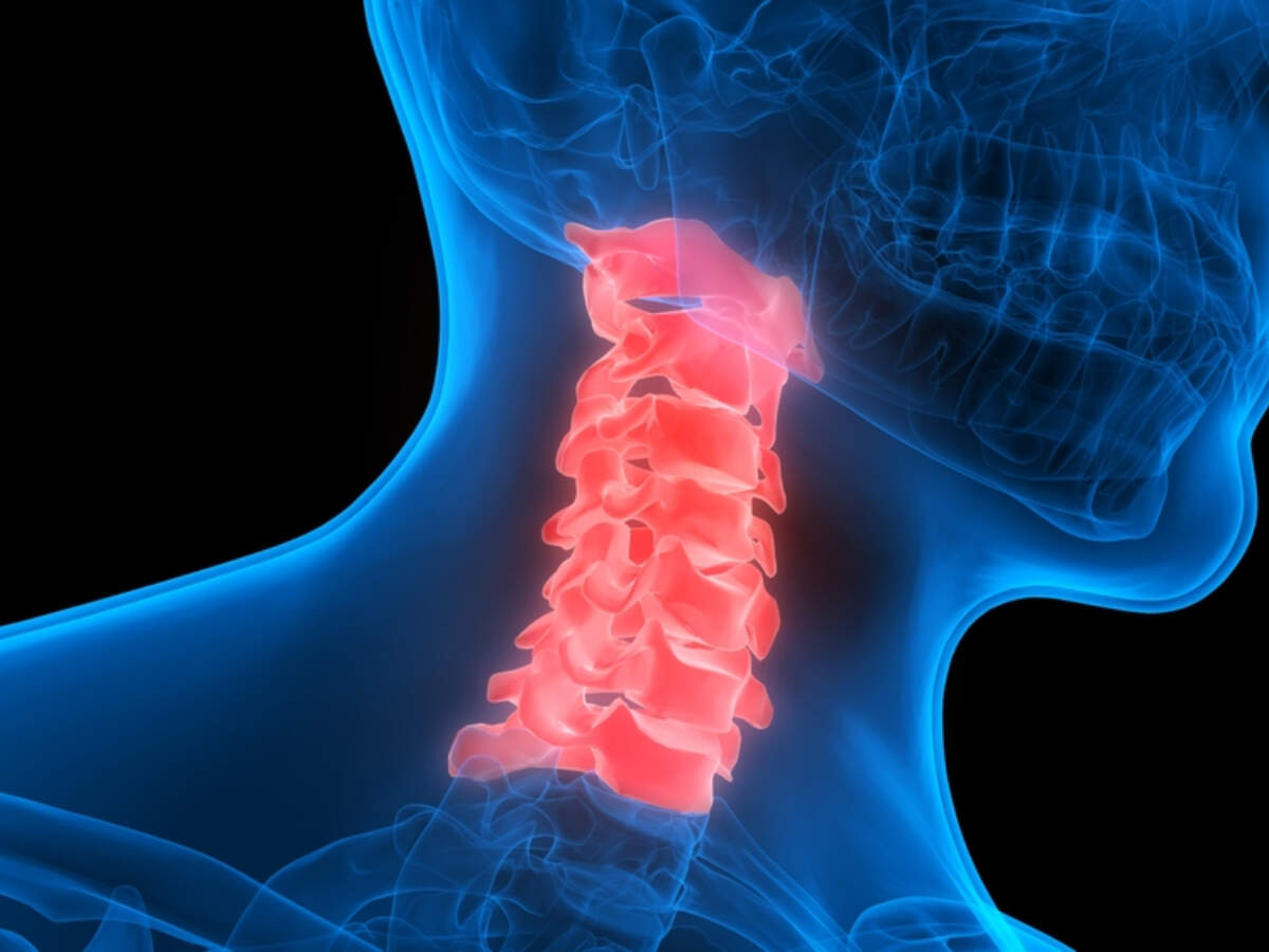 Cervical pain home remedies: Avoiding these foods can help in relieving ...