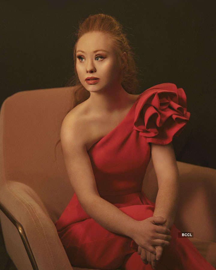 Meet Madeline Stuart Worlds 1st Supermodel With Down Syndrome The Etimes Photogallery Page 8 