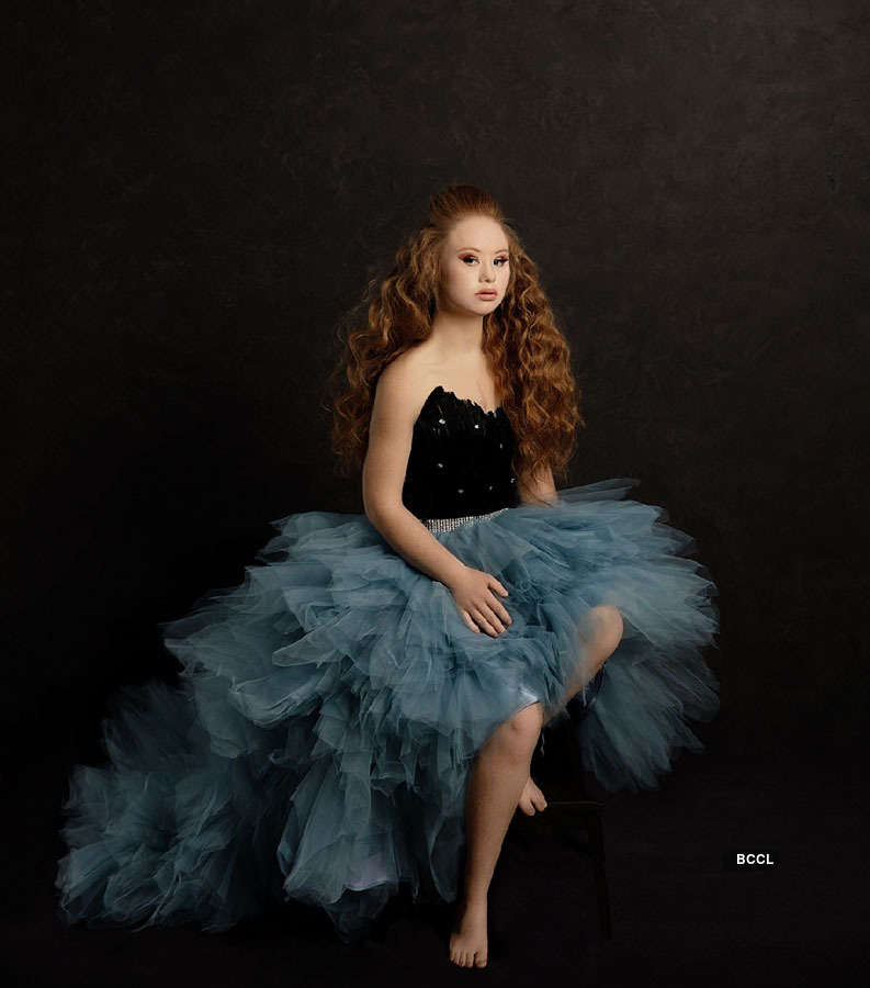 Meet Madeline Stuart Worlds 1st Supermodel With Down Syndrome The