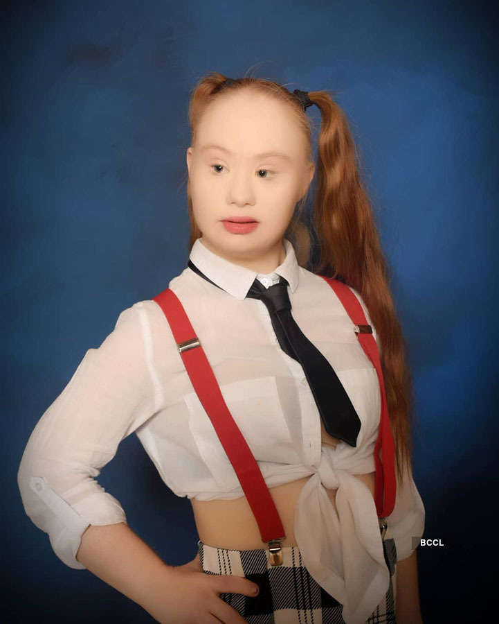 Meet Madeline Stuart, world's 1st Supermodel with Down Syndrome