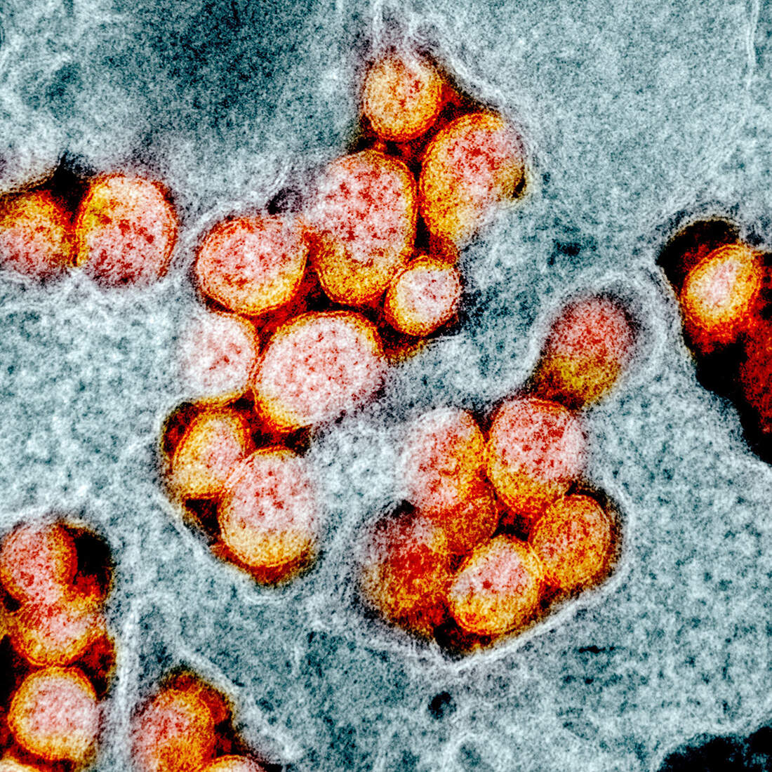 In Pictures: Up close with the coronavirus...