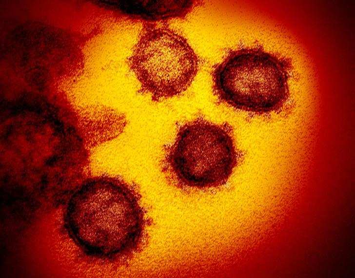 In photos: Up-close with the coronavirus