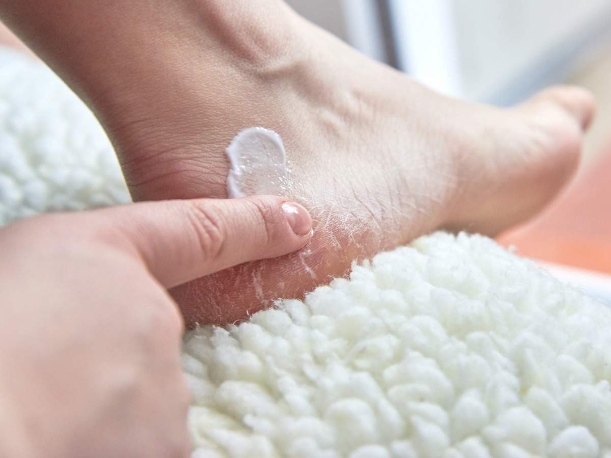 How to Treat Cracked Feet for Soft, Smooth Heels