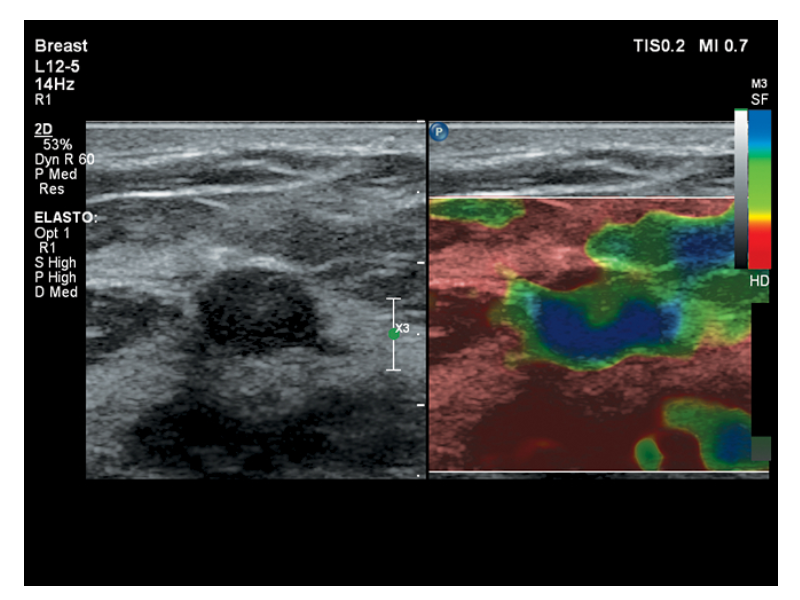 Mamography_Machine Mamography_Machine