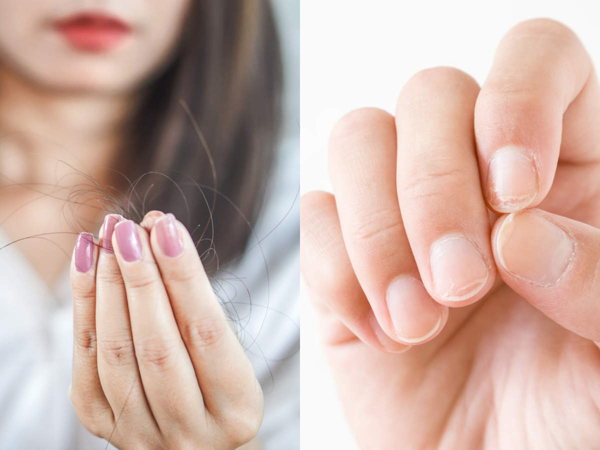 6 foods to strengthen your hair and nails | The Times of India