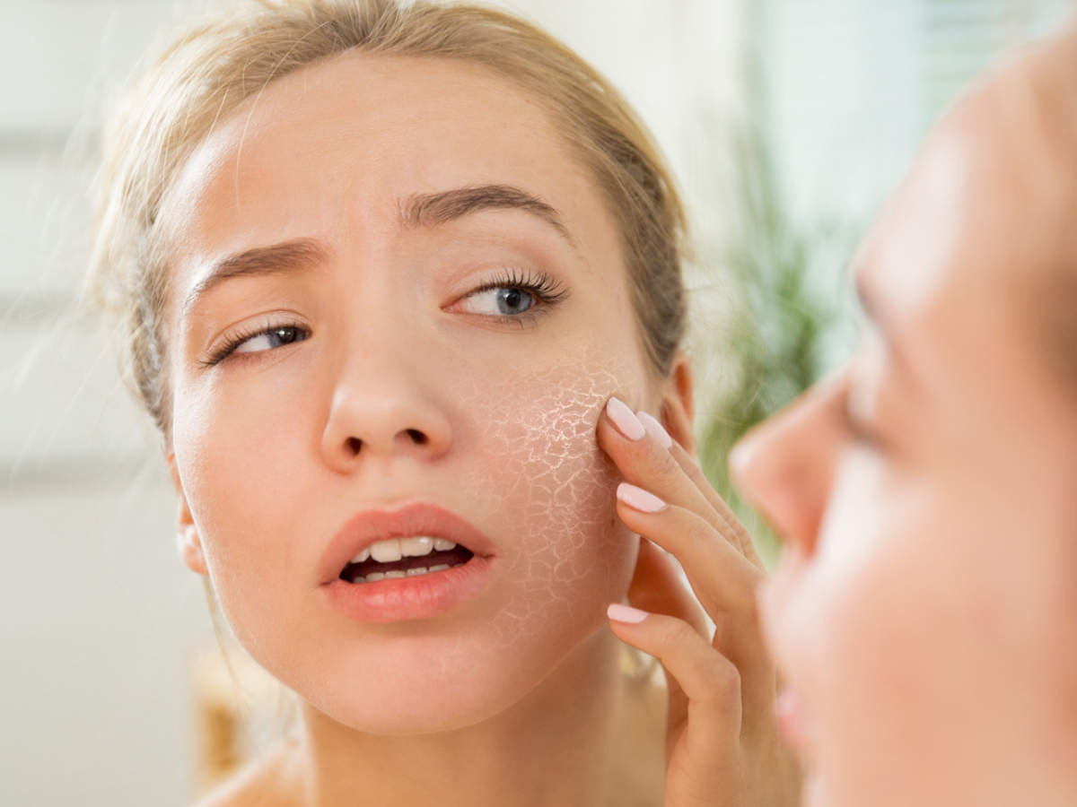 Suffer from very dry skin? These are the reasons! | The Times of India