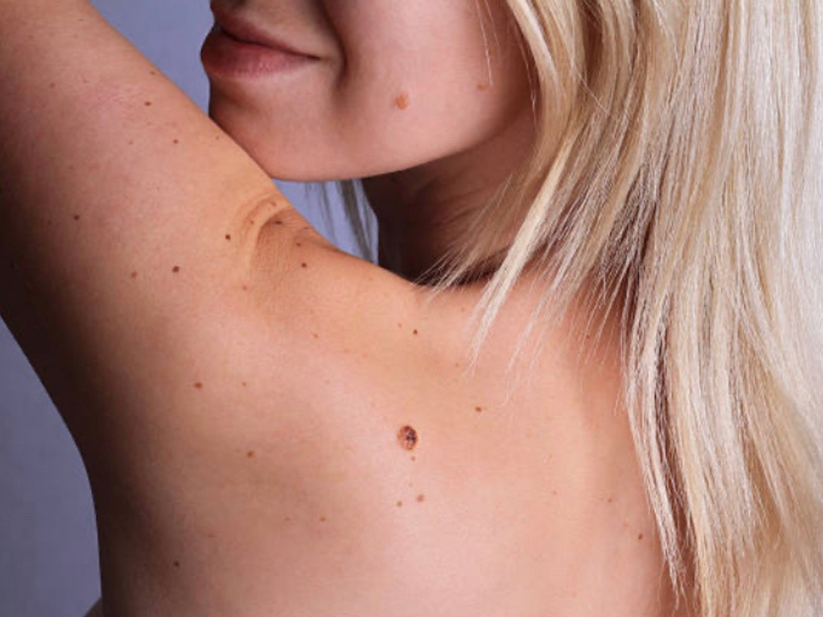 What the moles on your body reveal about your past life