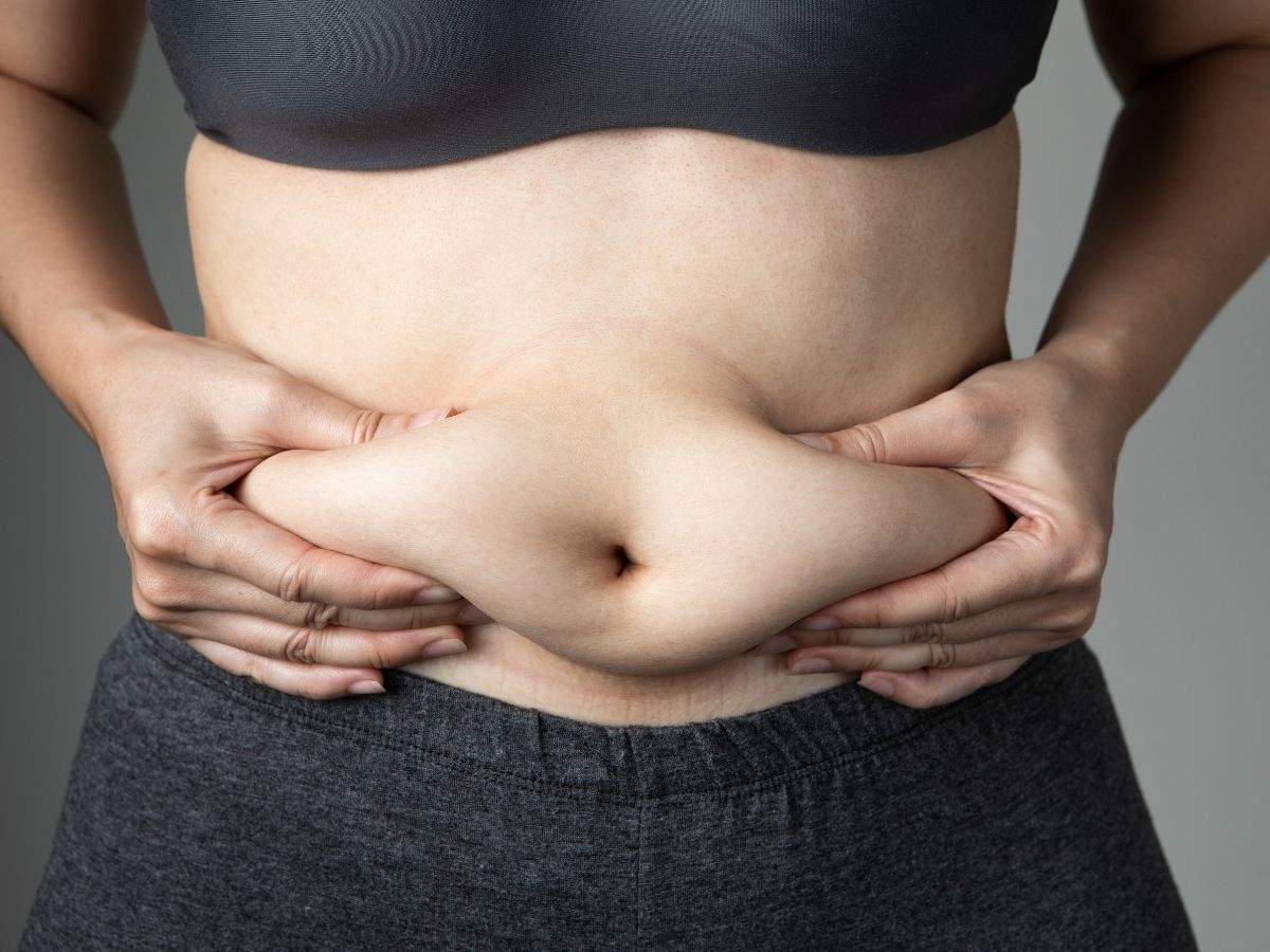 obese belly women